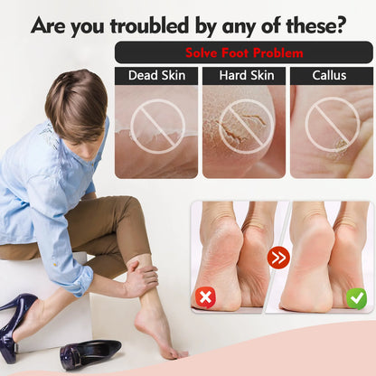 BIMZUC Nail Kit, 20 in 1 Pedicure Kit: Foot Scrub, Callus Remover, Cuticle Care, Toe Clippers, More for Manicure and Pedicure