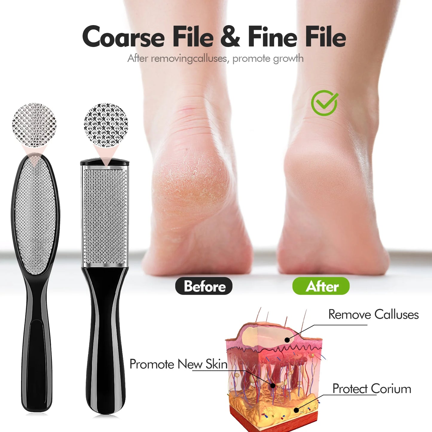 BIMZUC Nail Kit, 20 in 1 Pedicure Kit: Foot Scrub, Callus Remover, Cuticle Care, Toe Clippers, More for Manicure and Pedicure